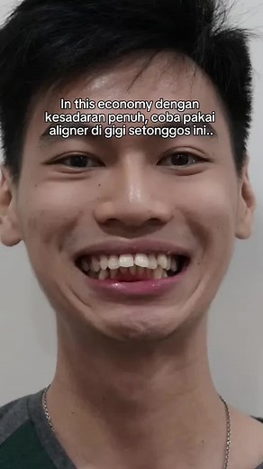 Aligner™️ untuk Rata Gigi dalam 3-6 Bulan