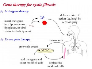 Gene therapy for cystic fibrosis - SlideServe