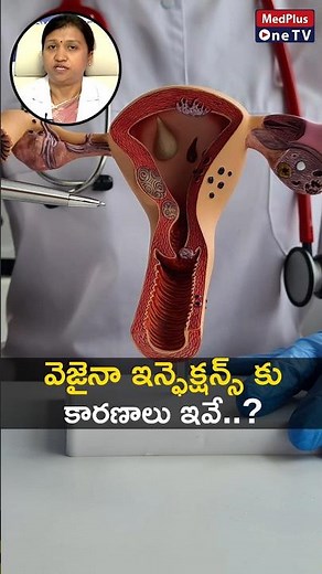 Vaginal Infections : Unveiling the Reasons Behind Dr. Varalakshmi #shorts @MedPlusONETV