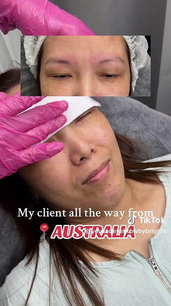Eyebrow Aesthetics at You and Eyebrow Clinic