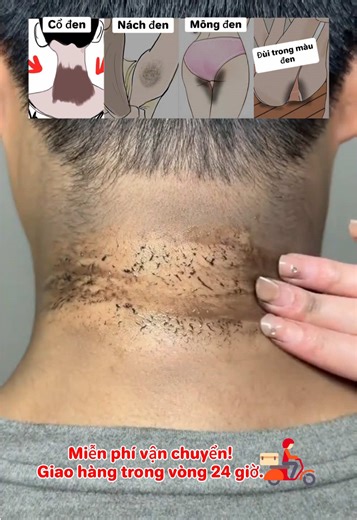 😘💁 SHEEureka tẩy tế bào chết nhẹ nhàng, chứa thành phần chlorella, nếu kiên trì sử dụng không chỉ có thể cải thiện độ tối của da, nếu bạn có nhu cầu ở nách, bạn cũng có thể sử dụng, thành phần nhẹ nhàng và an toàn, có thể làm sạch da đồng thời cũng có thể làm trắng da của bạn, ❤️🥳hơn nữa sẽ không bị căng, bây giờ hai cái rất hợp lý, bạn có thể mua lại và thử, nhấp vào chiếc xe nhỏ màu vàng bên dưới để đặt hàng.🌟🥰 #skincare #sheeureka #fyp #duongda #exfoliation VN6334