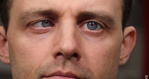 Learn how to move one eye without moving the other