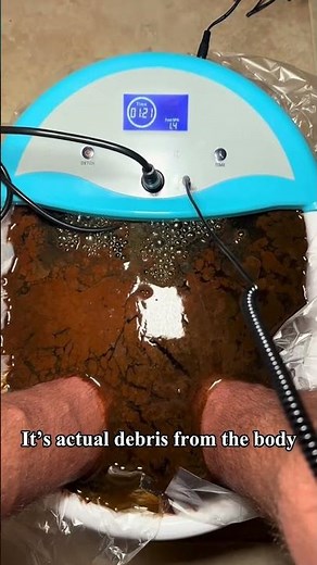 Ionic Foot Bath Detox Machine, Detox Ionic Foot Bath Ion Foot Spa Detox Machine Foot Spa