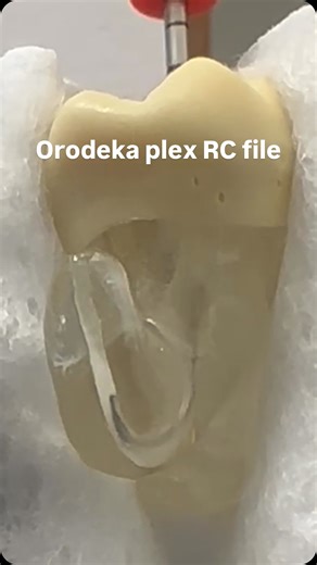 Rona _Orodeka on Instagram: "🔷 Orodeka Plex RC One File Reciprocating file Simplified Workflow · Standardized Treatment 🔹 One file, endless efficiency. Start your high-efficiency root canal journey — with just one file. ✅ Key Benefits: 🔹 No Extra Steps Needed Just a hand file to explore the canal — No orifice openers, no glide path files required. 🔹 One File for the Entire Preparation ✔ Effortless canal shaping in a single step ✔ Fewer instruments used ✔ Lower inventory and treatment costs ✔