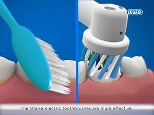 The Benefits of Electric Toothbrushes