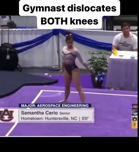 Anatomy & Injuries | Auburn gymnast Samantha Cerio dislocated and fractured both knees/legs (unknown fracture details) during this routine. This obviously ended... | Instagram