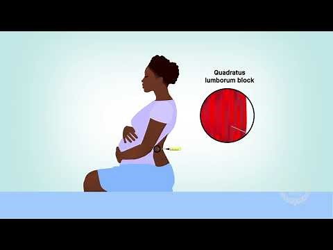 Quadratus lumborum block for cesarean delivery