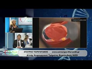 Σταύρος Τσιριγωτάκης,χειρουργός θυρεοειδούς, πως γίνεται η αφαίρεση του θυροειδή?