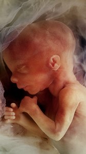 1.8M views · 50K reactions | Interesting facts about pregnancy. #Science #Research #Biology | Hashem Al-Ghaili | Facebook