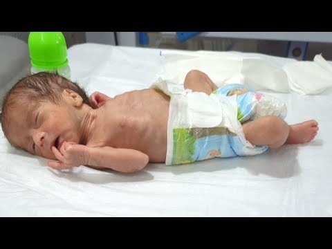 Fazl Neonatologist | Neonatal Care & NICU Education