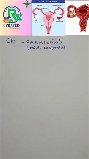 Endometriosis Treatment Options and Dosages Explained