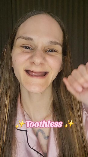 ✨️ Toothless to FULL All-On-6 Dental Implants! ✨️ Thank you to the wonderful team at Jax Implants for creating my dream smile. 😊 @JAX Implants & Dentures #toothless #dentalimplants #denturegang #teeth #smile #transition #transformation