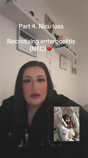 Understanding Necrotizing Enterocolitis and NICU Loss