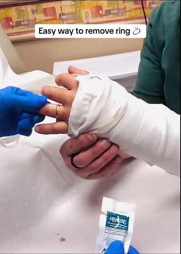 How to Remove a Ring - Easy Methods and Techniques