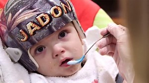 Separated conjoined twins Jadon and Anias McDonald getting stronger every day