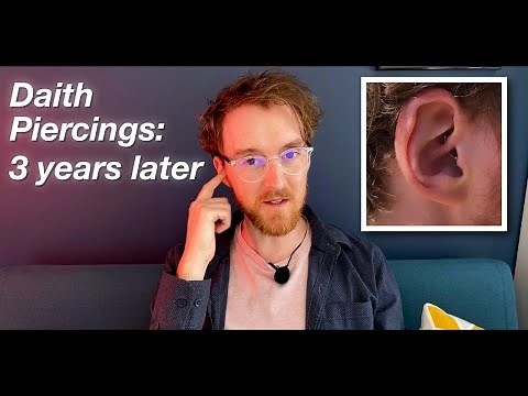 Do Daith Piercings help with Migraine? A long term review. 3 Years Later.