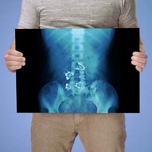 Stock up on Stomach Butterflies at Cedar Point. You’ll need them when you’re waiting for the floor to drop out and send you plunging six stories down Point Plummet. | Cedar Point