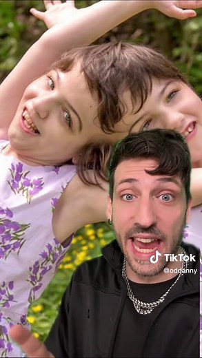 Conjoined Twins Share a Brain: The Hogan Twins