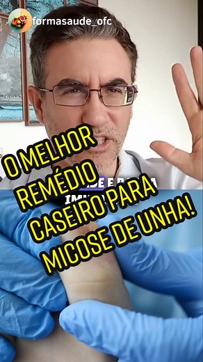 O melhor remédio caseiro para micose de unha! - Dr. Tiago Rocha #saude...