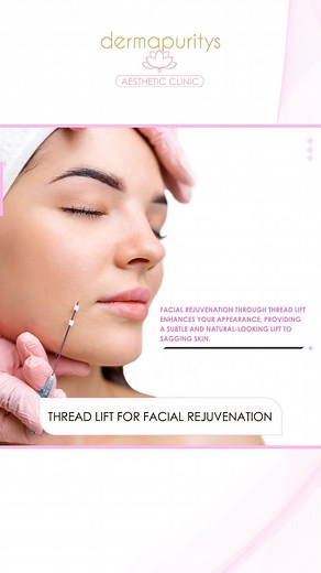 Thread lift treatment offers facial rejuvenation benefits through a minimally invasive procedure: · Non-Surgical Lift: Lifts sagging facial tissues without surgery. · Collagen Stimulation: Promotes collagen production for improved skin elasticity. · Natural-Looking Results: Creates a subtle and natural lift. · Quick Recovery: Minimal downtime compared to traditional facelift surgery. · Long-Lasting Effects: Results can last for several months to a year. · Customizable: Tailored treatment to addr