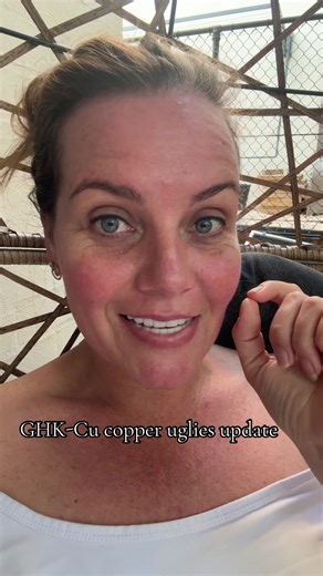 Update on GHK-Cu Copper Peptides for Biohacking