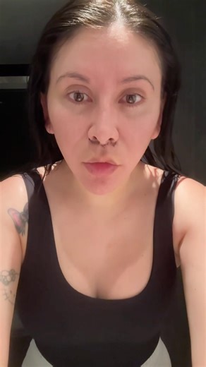 Day 4 Facelift & Lip Lift Recovery | Is It Worth It Already?!