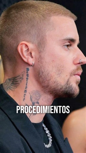 Justin Bieber's hair transplant 🤯 #devilstyle #hair #justinbieber #hairtransplant