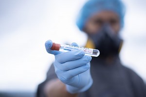 Koronawirus 10.12.2021. Kolejny ogromny wzrost. Niepokojące informacje [RAPORT, 10 GRUDNIA]