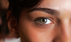 Nikon buys hi-tech eye specialist Optos