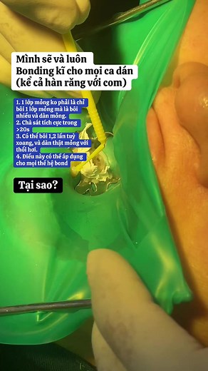 1. Bay hơi dung môi * Tác dụng của chà sát: Động tác chà sát liên tục giúp phá vỡ sức căng bề mặt, dàn mỏng lớp keo, giúp dung môi (cồn/acetone) bay hơi nhanh hơn và đẩy nước từ trong ống ngà đi lên bề mặt để thổi khô sau đó. Điều này giúp thay thế hoàn toàn nước bằng nhựa (resin). 2. Tăng cường khả năng xâm nhập vào lưới Collagen Ngà răng có áp lực dịch ống ngà luôn đẩy từ tủy ra ngoài. Keo dán muốn chui sâu vào trong để tạo lớp lai (hybrid layer) thì phải