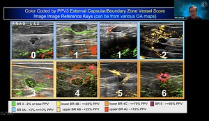 Introduction to Opto-Acoustic Imaging, NCoBC 2021