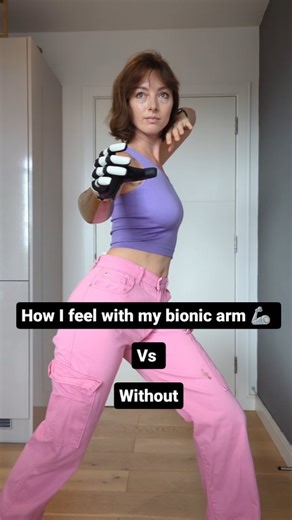 39 reactions · 3 comments | All jokes  I feel powerful either way! Sometimes having a Bionic arm is specifically cool because I feel like I can customise my earth avatar 料藍 upgrades people! #BionicBarbie #amputeelife | Ashley Young | Facebook