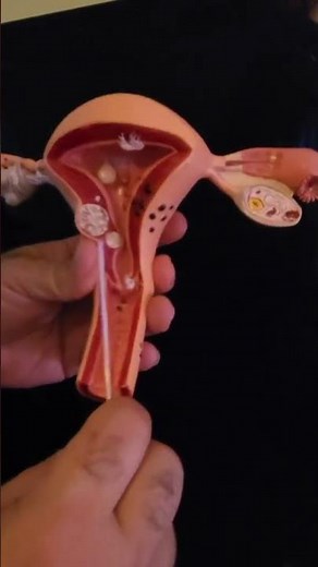 how do we get a uterine endometrial biopsy?