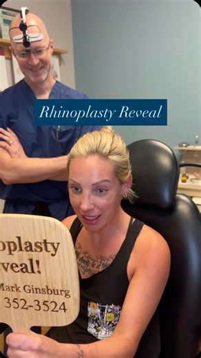 My patient wanted a less than flat dorsum, reduced columella show, and a supratip break. After patiently spending her first week after surgery healing in her cast, she is able to finally get her first peek at her new nose 😊 #rhinoplasty #facialplasticsurgery #beforeandafter #plasticsurgery #nosejob #rhinoplastyresults Dr. Mark Ginsburg Board Certified Facial Plastic Surgeon Rhinoplasty Specialist www.providencefacialplastic.com Providence Facial Plastic and Cosmetic Surgery 500 Evergreen Drive 