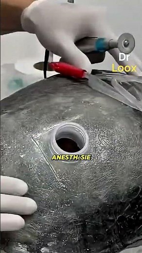 How they repair a turtle's shell