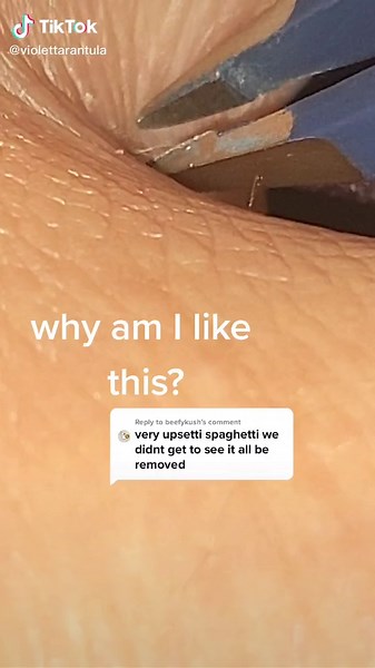 Removing Hair Splinters from Dog Paws and Chin - Expert Tips