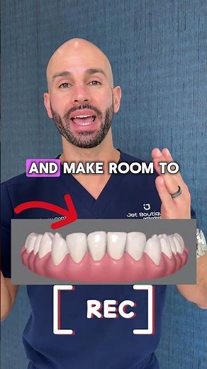 Rotated lower front teeth being fixed with Invisalign.