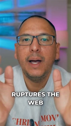 Treating Esophageal Webs: The EGD Solution! #GIdisease