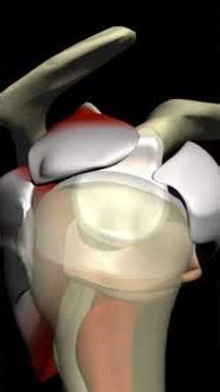 MDI: When Your Shoulder Capsule Is Too Loose