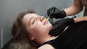 Hair removal master applies wax on client's face. Removal woman's mustache with wax. Close-up