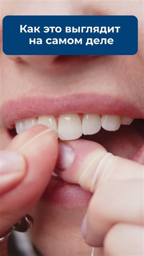 Biorepair 🇮🇹 Зубная паста, щётка | ополаскиватель on Instagram: "🙅🏻 Никаких резких и быстрых движений 🙋🏻 Нить необходимо прижать к поверхности зуба, и плавно, полностью очистить боковую сторону. То же повторить с противоположным зубом. Хорошая домашняя гигиена – это множество нюансов, которые важно знать. Для вашего удобства все эти правила я собрала в одном видеоуроке. Если хотите с ним ознакомиться, напишите в комментариях слово «Урок», и я отправлю вам ссылку на него 🔗"