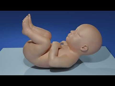 Rectal Irrigations for Hirschsprung’s Associated Enterocolitis