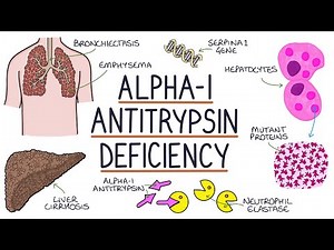 Understanding Alpha-1 Antitrypsin Deficiency