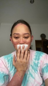 Dokter udah review ciri2 krim kosmetik yang berbahaya masih aja kalian ngeyel dan tetap pakai karena udah ketergantungan. Kalau udah kena seperti ini, kira2 ownernya mau ngobatin penyakitmu gara2 udah pakai kosmetiknya ??? | Syachroel Syamsir