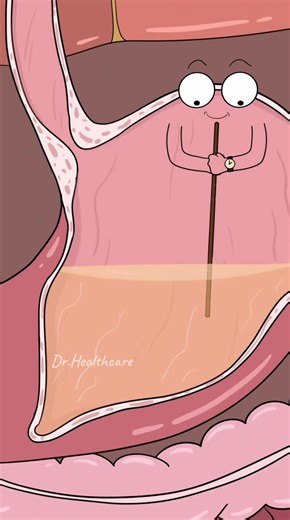 Effects of Overdosing on Sleeping Pills Explained