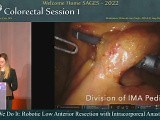 How We Do It Robotic Low Anterior Resection with Intracorporeal Anastomosis • Video • MEDtube.net