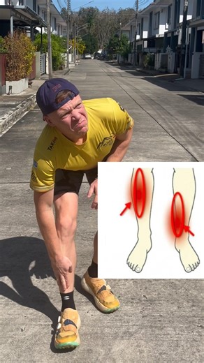 Shin Splints 😣 😭 #runningtips #runninglife #ultrarunners #runningnz #trailrunninglife