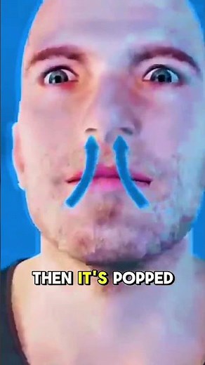 Sinus Balloon Procedure 3D Animation