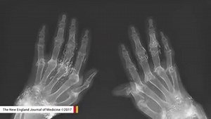 How safe is your hospital? Survey grades SF-area medical centers