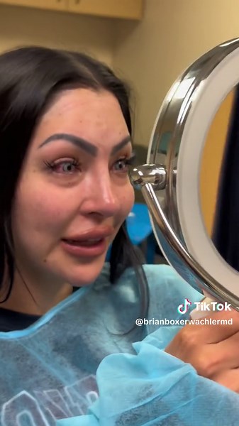 ColorEyes Procedure for Steel Blue Eyes